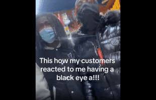Customers Was Ready To Step Behind Their Store Homie After He Pranked Them About Having A Black Eye!