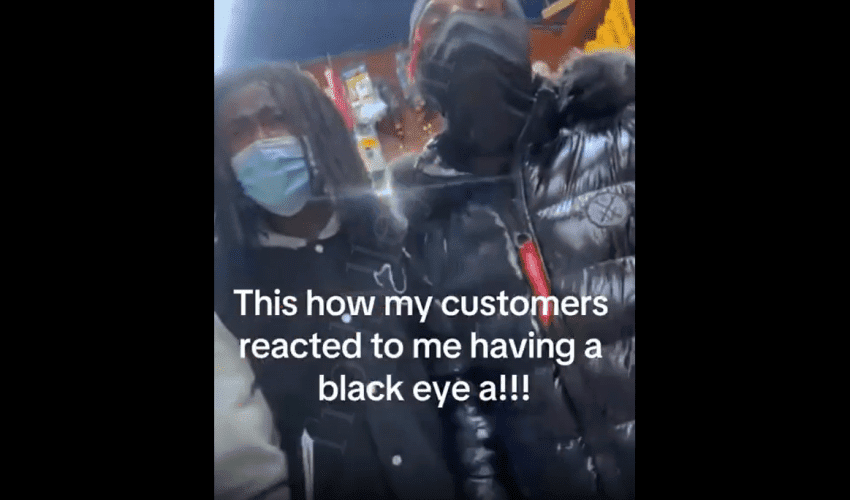 Customers Was Ready To Step Behind Their Store Homie After He Pranked Them About Having A Black Eye!