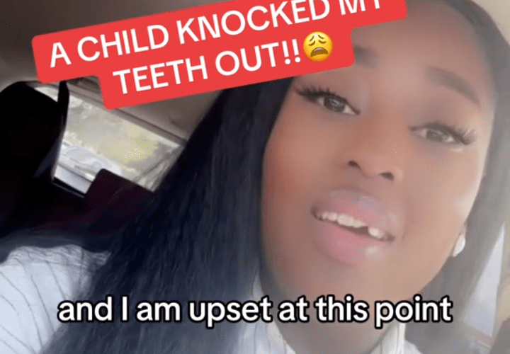 Woman Gets Her Teeth Knocked Out By Her Bestfriend Child Because She Wouldn’t Leave Their House