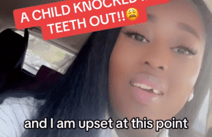 Woman Gets Her Teeth Knocked Out By Her Bestfriend Child Because She Wouldn’t Leave Their House