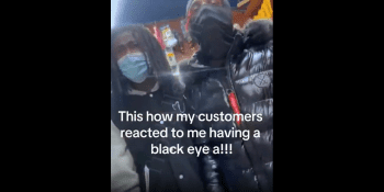 Customers Was Ready To Step Behind Their Store Homie After He Pranked Them About Having A Black Eye!