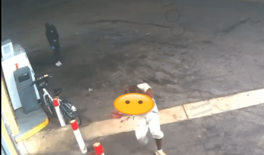 Warning Graphic: Dude Couldn’t See After Getting Shot In The Back Of His Head By His Opp