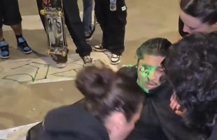 LAPD Fired A Paintball And Accidentally Damaged A Guy Eye
