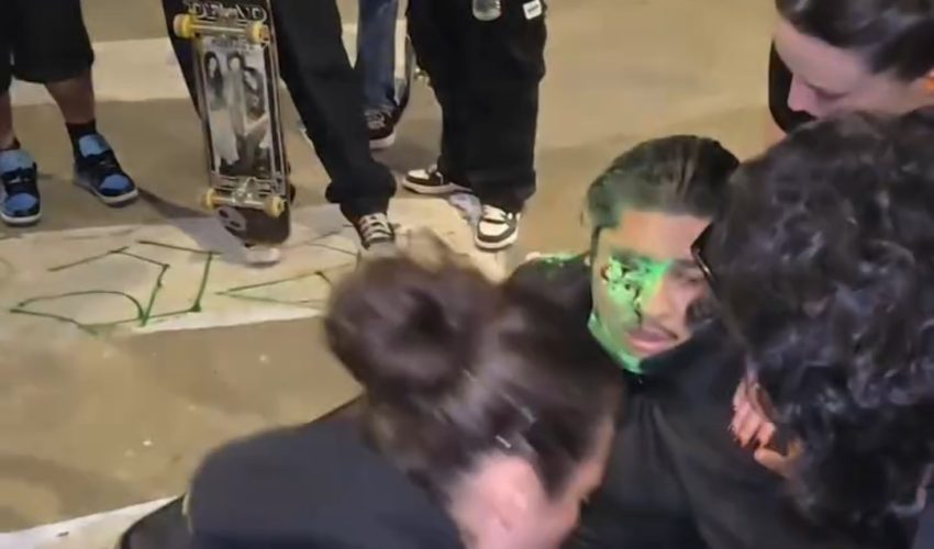 LAPD Fired A Paintball And Accidentally Damaged A Guy Eye