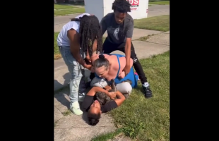Woman Screams For Help After Another Woman Tried To Take A Chunk Of Her Leg Off